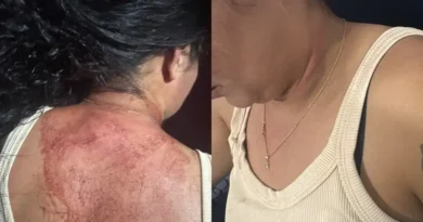 Mulher é agredida pelo ex-marido em Ipu; filha de 5 anos pede socorro e ajuda a mãe a escapar