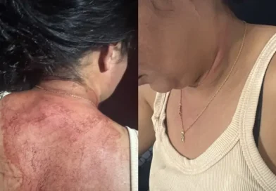 Mulher é agredida pelo ex-marido em Ipu; filha de 5 anos pede socorro e ajuda a mãe a escapar
